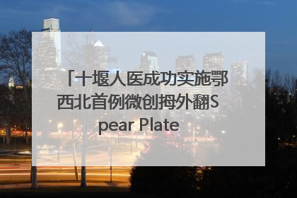 十堰人医成功实施鄂西北首例微创拇外翻Spear Plate髓内板矫形术